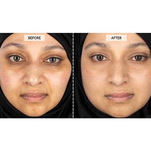 CurrentBody Skin LED Light Therapy Face Mask | Red Light Device for Firmer, Plumper & Brighter Skin | Anti-Aging Face Mask