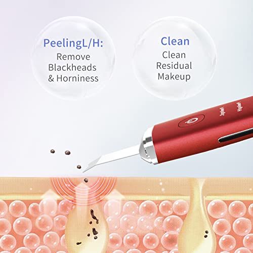 COSBEAUTY Skin Scrubber Face Spatula, Blackhead Remover Pore Cleaner Comedo Extractor with 4 Modes, Waterproof IPX6, Wireless Rechargeable (Red)