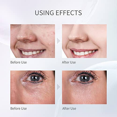 COSBEAUTY Skin Scrubber Face Spatula, Blackhead Remover Pore Cleaner Comedo Extractor with 4 Modes, Waterproof IPX6, Wireless Rechargeable (Red)