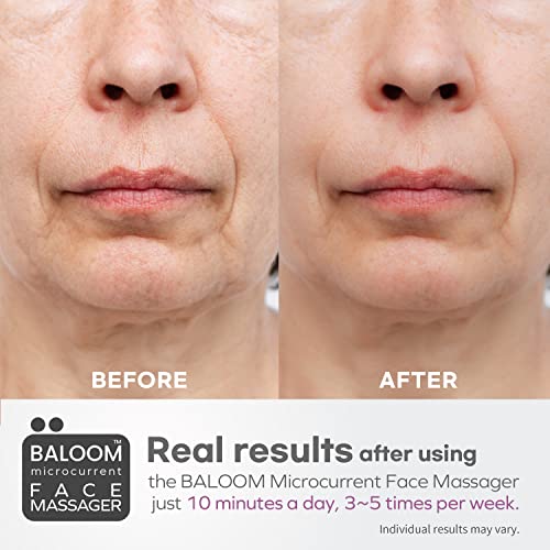 Baloom Microcurrent Facial Massager - Skin Tightening Care for Women and Men - Face/Body Wrinkle Removal, Anti Aging, Skin Rejuvenation, Face Lift , Acne Spot Treatment - 10 Minutes A Day.